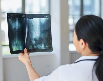 A medical professional examines spine and pelvis X-rays, back to camera. The bright windows suggest a clinical environment, conveying focus and analysis.